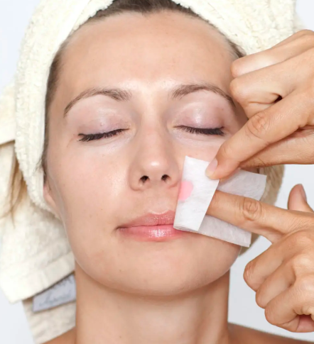 Waxing - Face Cheeks