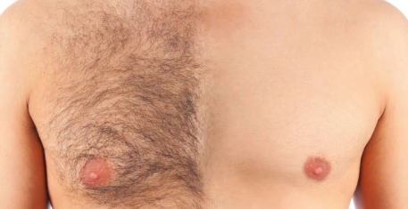 Waxing - Chest