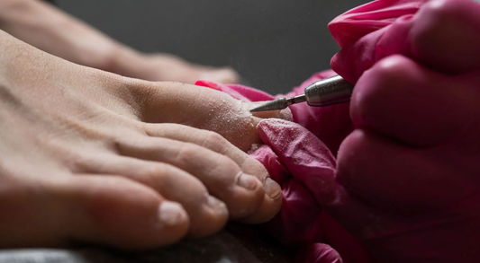 Shellac Toe Removal Only