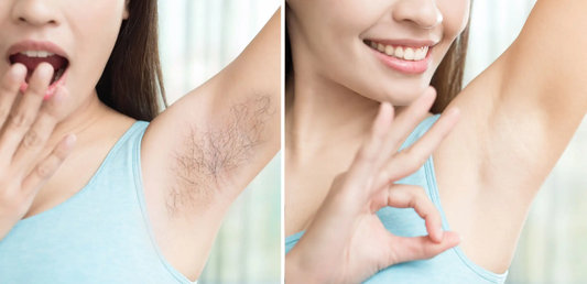 Waxing - Underarms